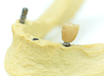 歯科口腔外科写真